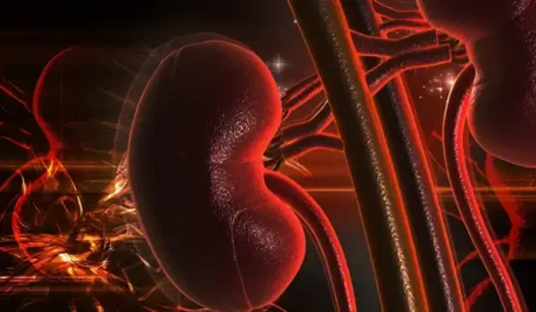 Tratamiento para la insuficiencia renal terminal en Culiacán, Sinaloa